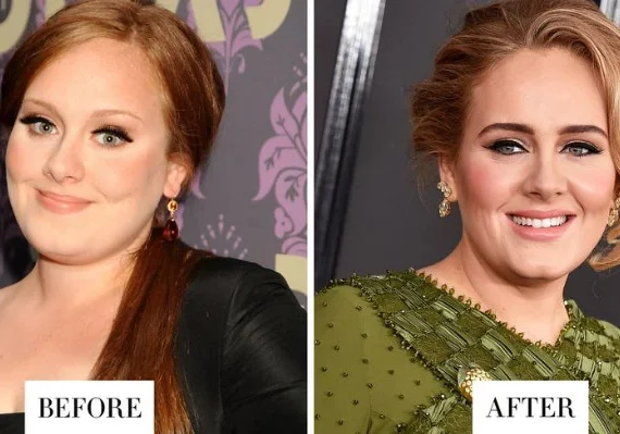 Adele’s Eyebrow Transformation