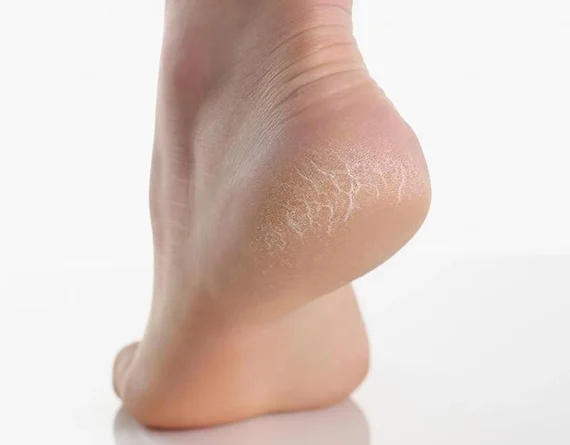 A professional medical pedicure session at Beauty by Ruth Liverpool, highlighting our latest Foot Health Treatment Offer for new and existing clients.