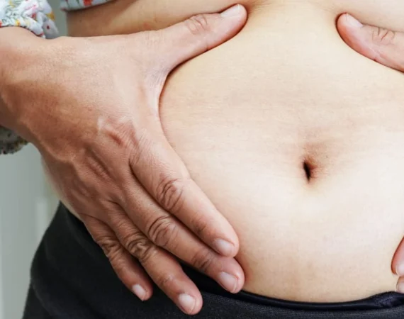Cryotherapy Liverpool Fat Reduction Treatments