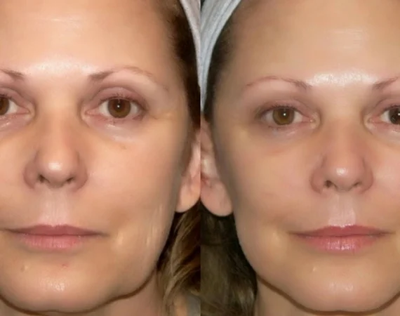 February Treatment Of The Month
