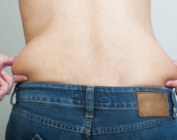 Beauty by Ruth Cryo Lipo Treatment