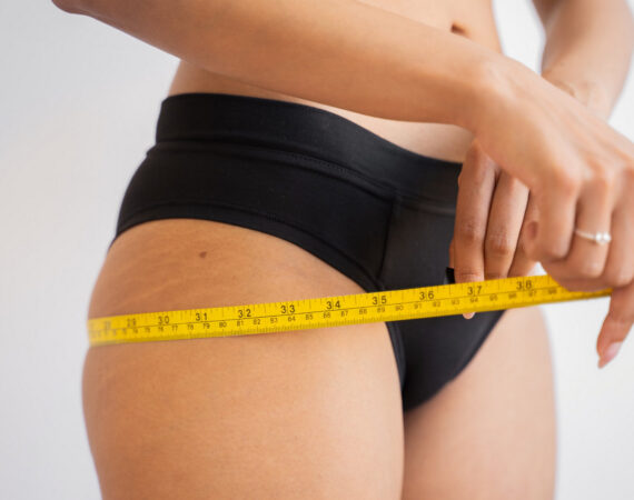 A professional cryotherapy treatment session at Beauty by Ruth Liverpool to freeze the fat off your thighs and reduce stubborn fat deposits.