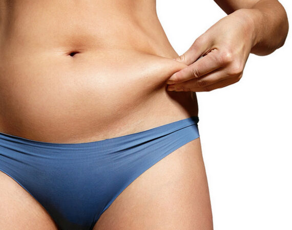 Fat Freezing Consultations Available