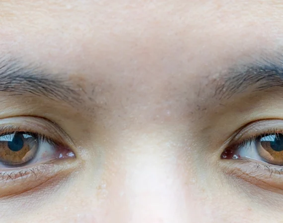 A relaxing eye rejuvenation treatment at Beauty by Ruth Liverpool to help Refresh Tired Eyes during the autumn months.