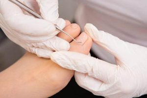New Medical Pedicure Treatment at Beauty by Ruth