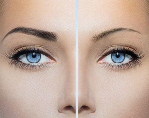 What Happens If You Don't Touch-Up Microblading